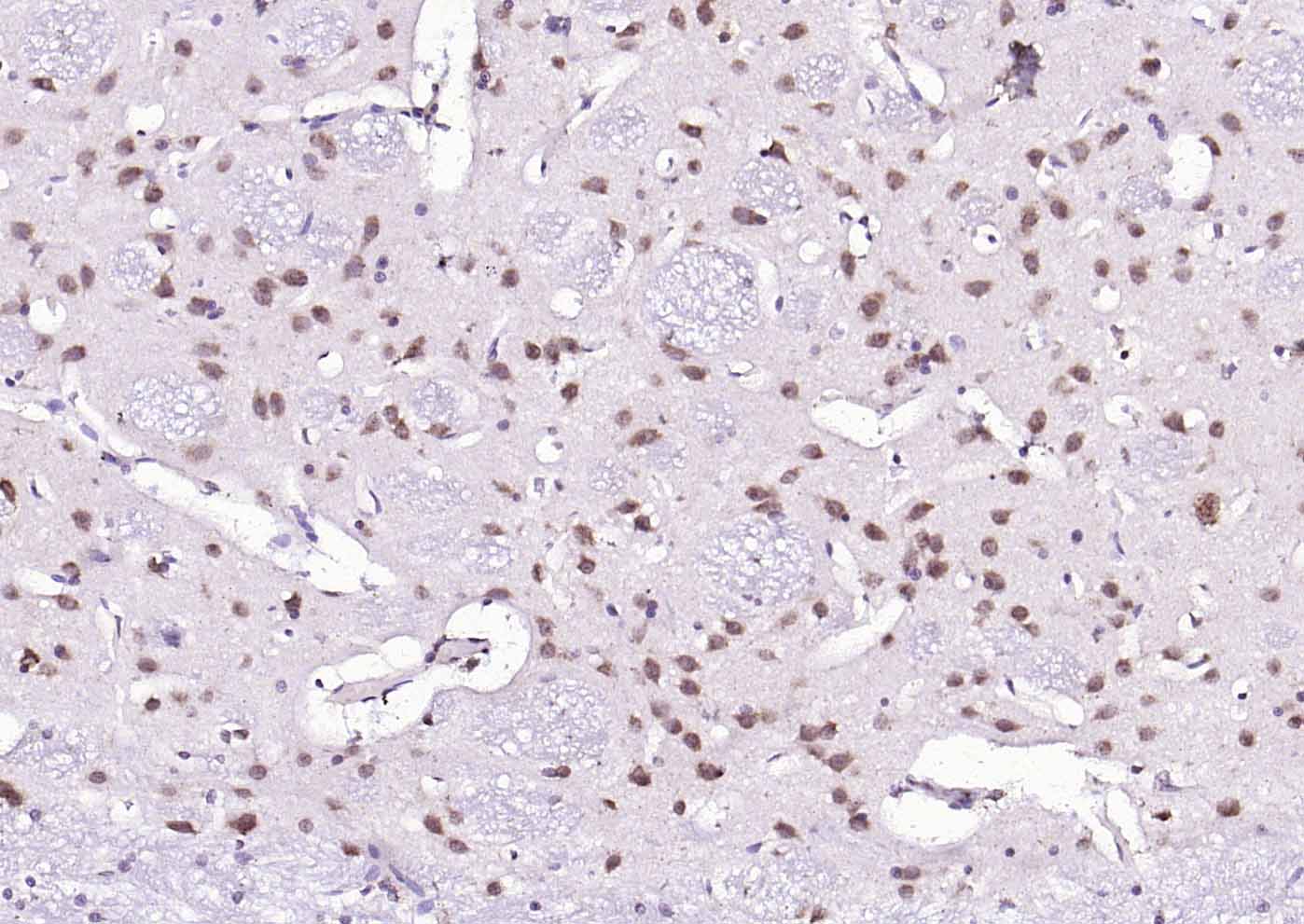 组蛋白乙酰转移酶PCAF抗体-bs-5130R