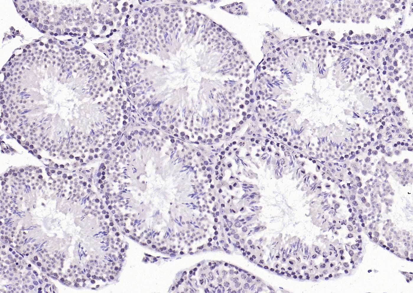 热休克因子1抗体-bs-3757R