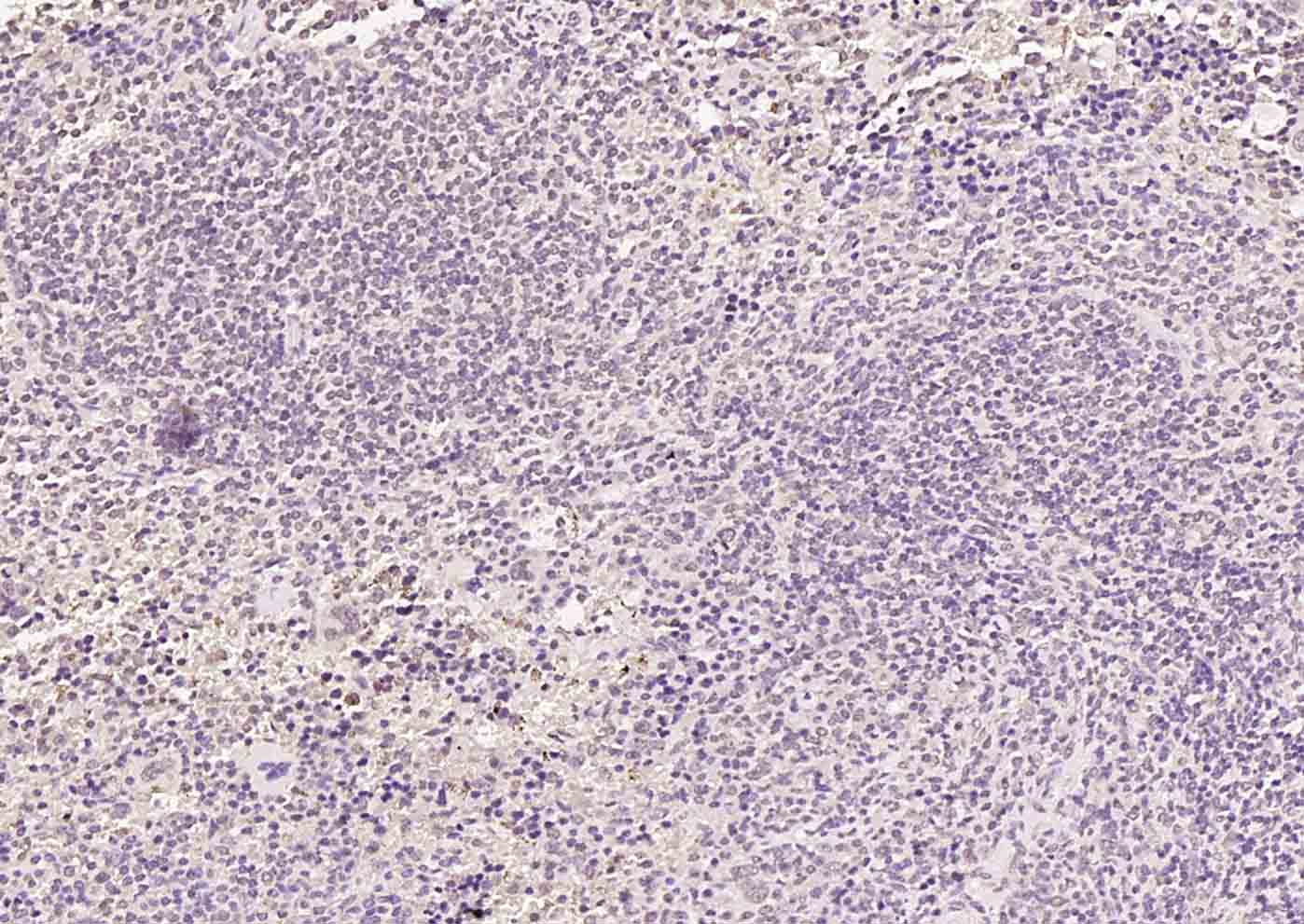 热休克因子1抗体-bs-3757R