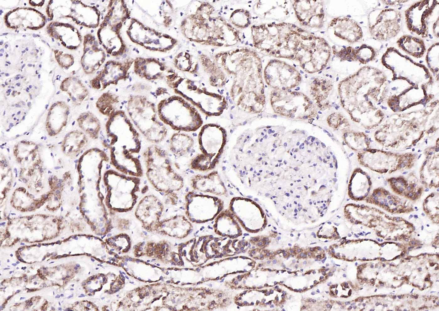组蛋白乙酰转移酶PCAF抗体-bs-5130R