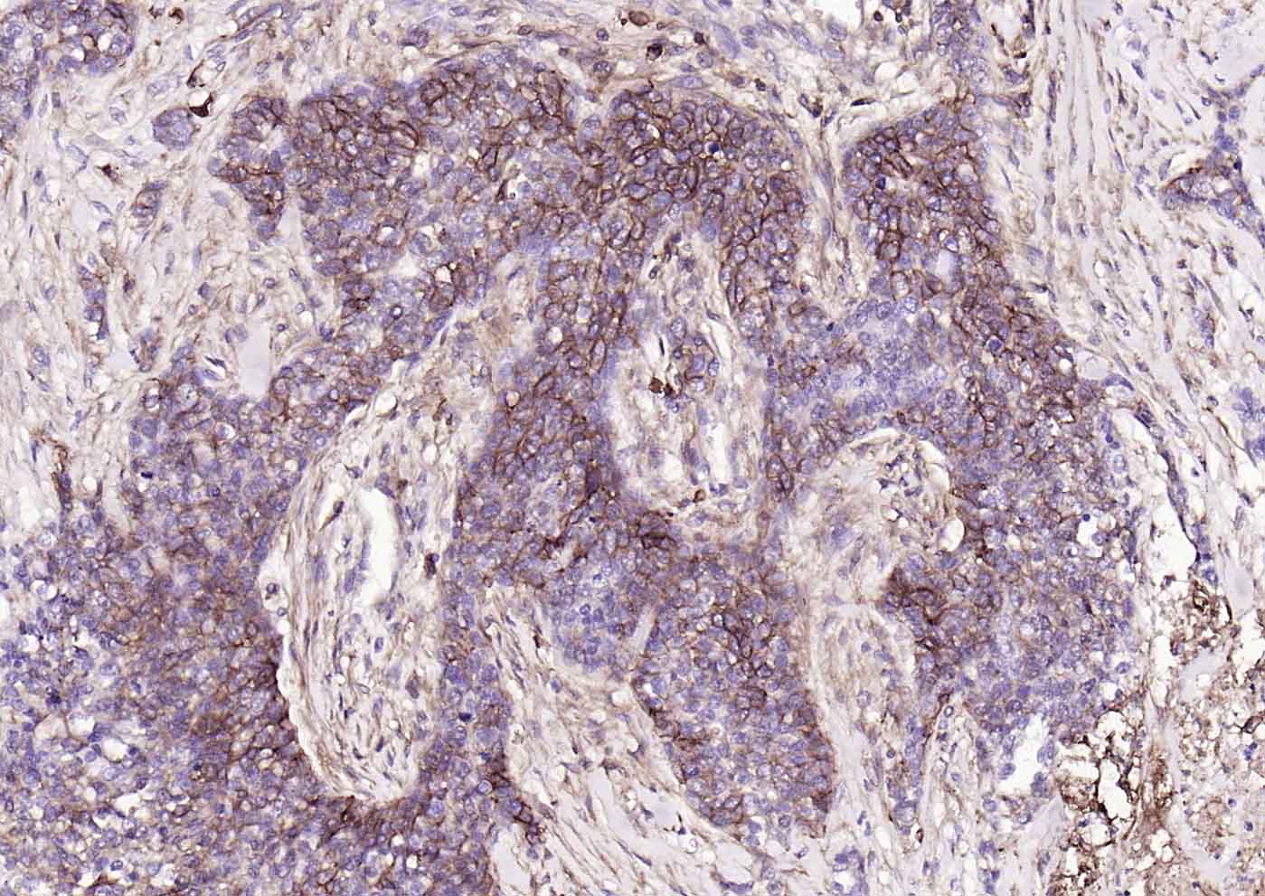 小鼠抗人CD44单克隆抗体-bsm-30038M