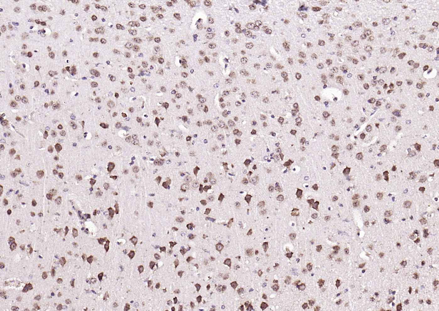 组蛋白乙酰转移酶PCAF抗体-bs-5130R