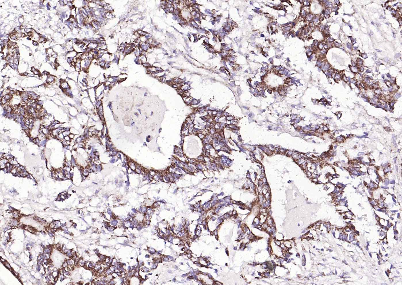 组蛋白乙酰转移酶PCAF抗体-bs-5130R