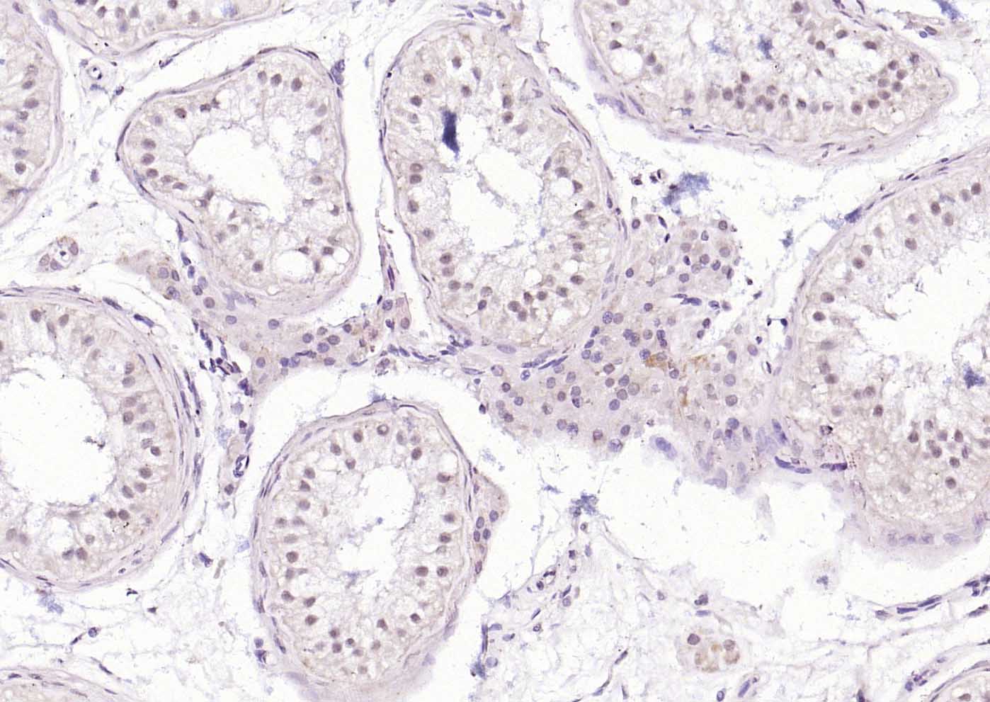 热休克因子1抗体-bs-3757R