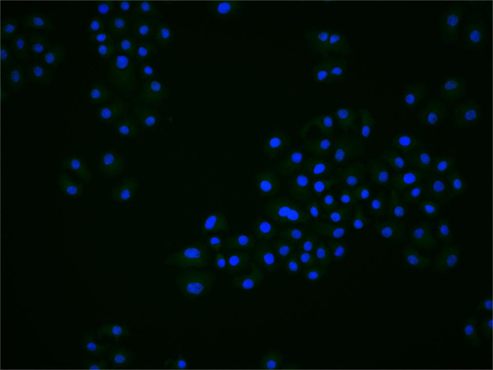 FBXL5蛋白抗体-bs-8468R