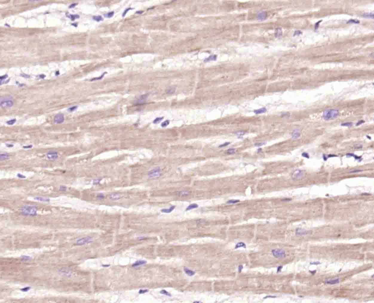 G蛋白结合蛋白RAB11a抗体-bs-11258R