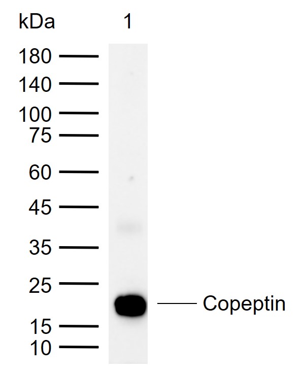 抗利尿激素/血管升压素/加压素/血管加压素抗体-bs-21741R