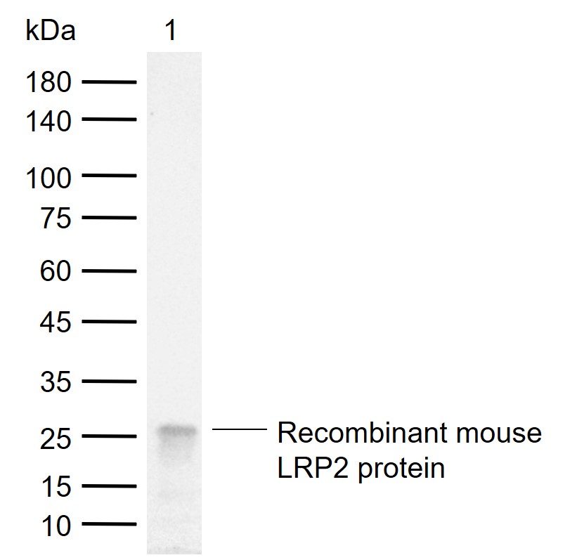 糖蛋白gp330重组兔单抗