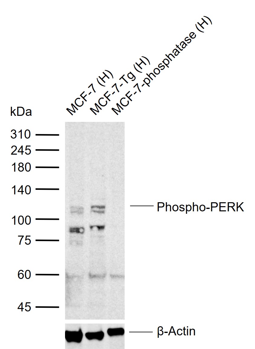 phospho-PERK (Thr980) Rabbit pAb (一抗) | Bioss