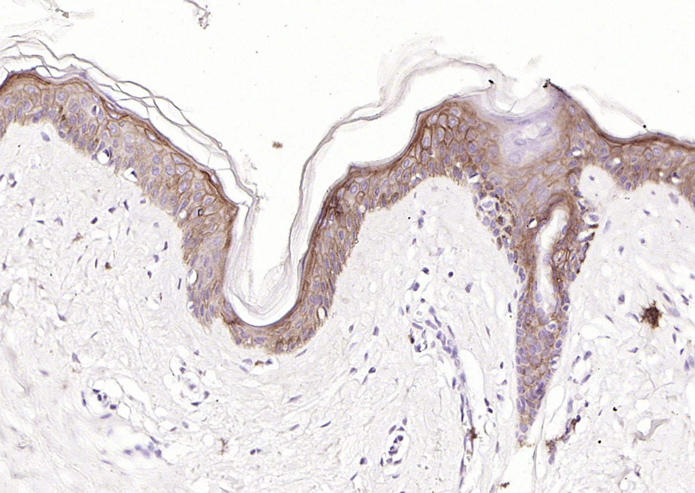 多配体蛋白聚糖1（CD138）重组兔单抗