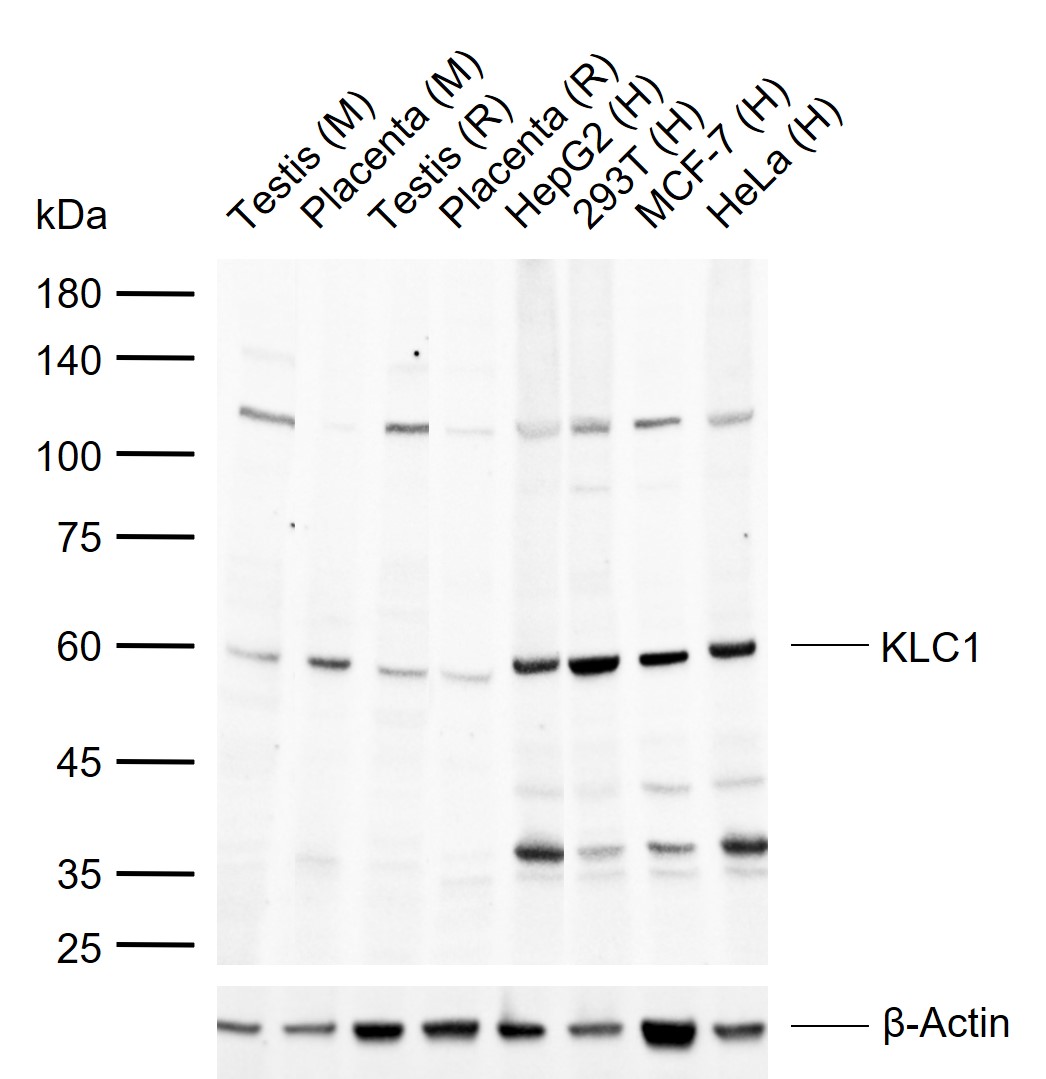 KLC1 Rabbit pAb (一抗) | Bioss