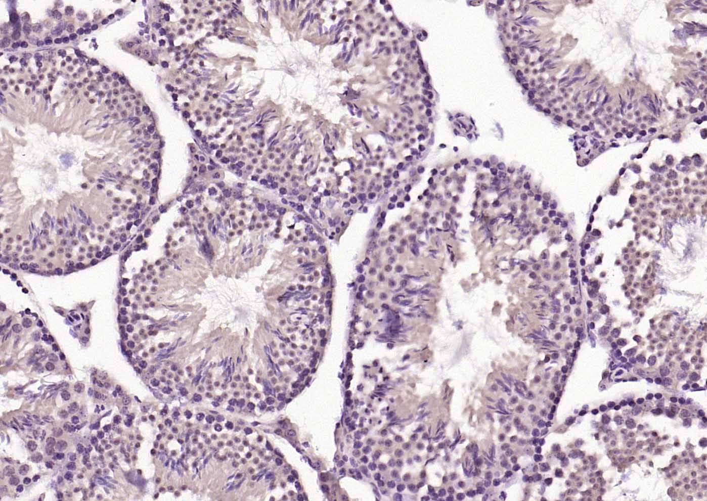 FBXL5 Rabbit pAb (一抗) - IHC-P,IHC-F,IF,Flow-Cyt,ICC/IF | Bioss