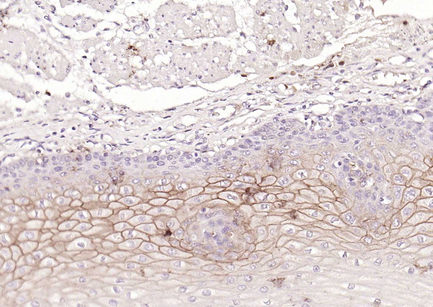 多配体蛋白聚糖1（CD138）重组兔单抗