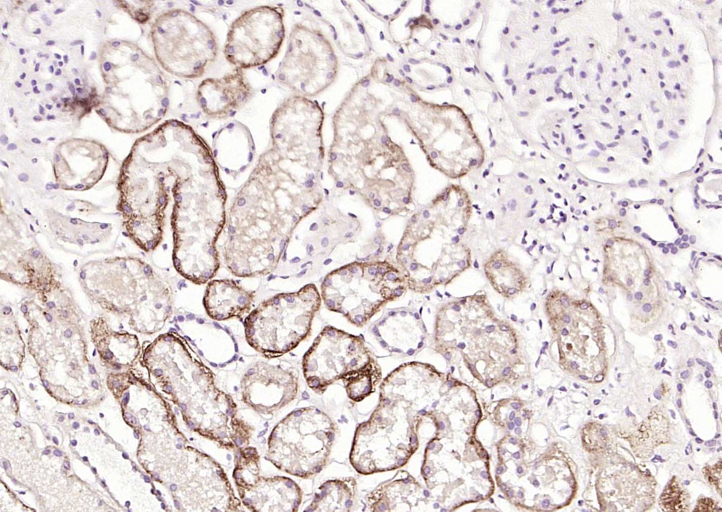 多配体蛋白聚糖1（CD138）重组兔单抗