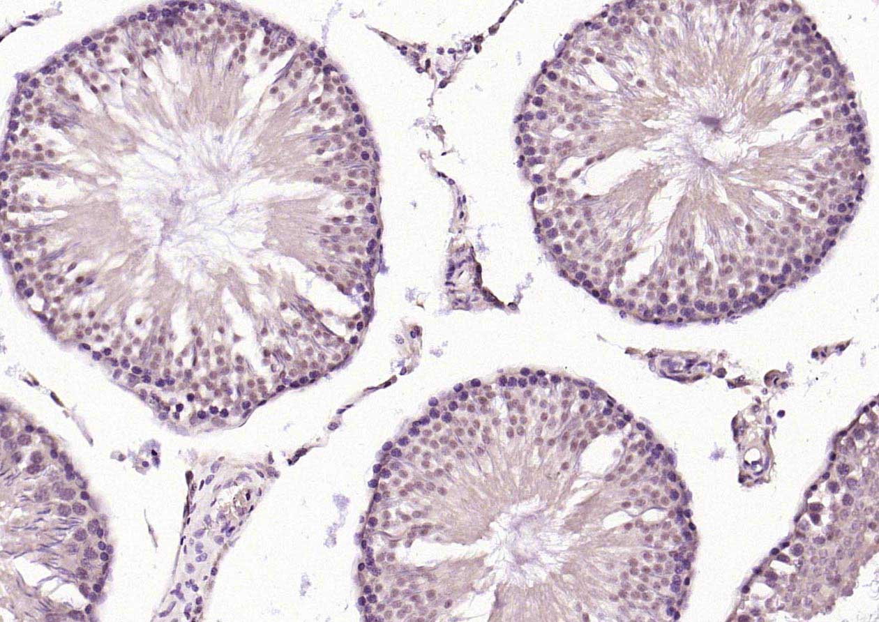 FBXL5蛋白抗体-bs-8468R