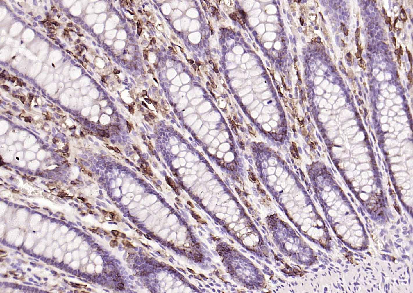 多配体蛋白聚糖1（CD138）重组兔单抗