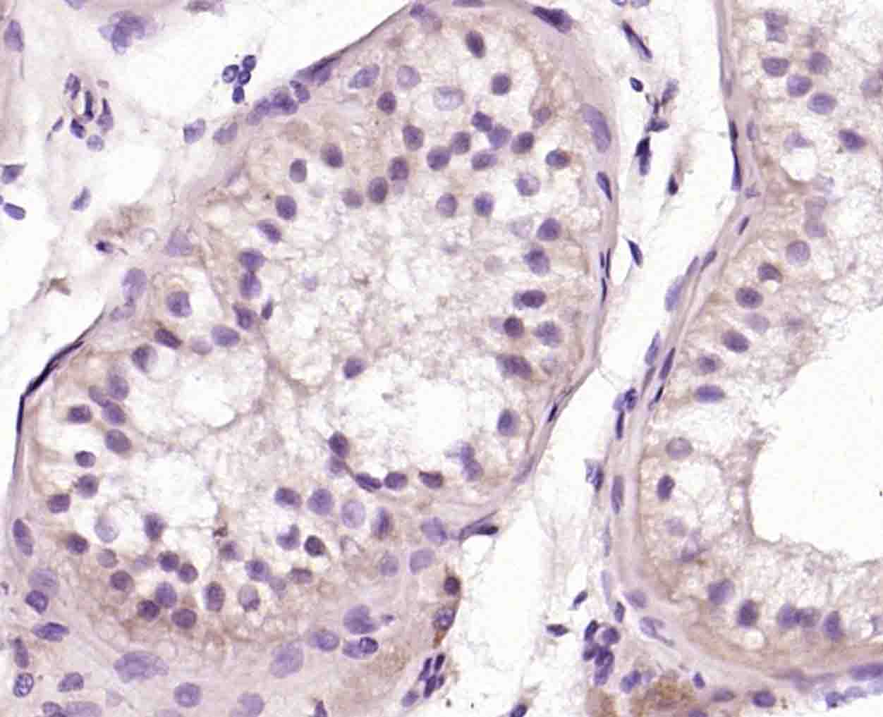 OSR1/OSR2蛋白抗体-bs-12377R