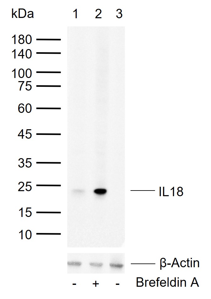 白细胞介素-18/干扰素γ诱导因子重组兔单抗