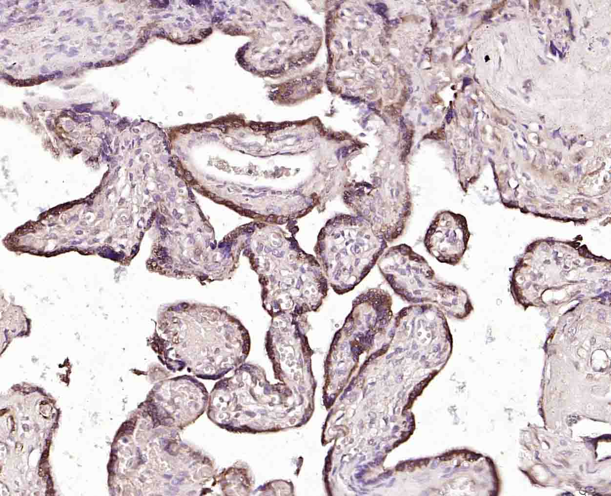 磷酸化一氧化氮合成酶3（内皮型）重组兔单抗