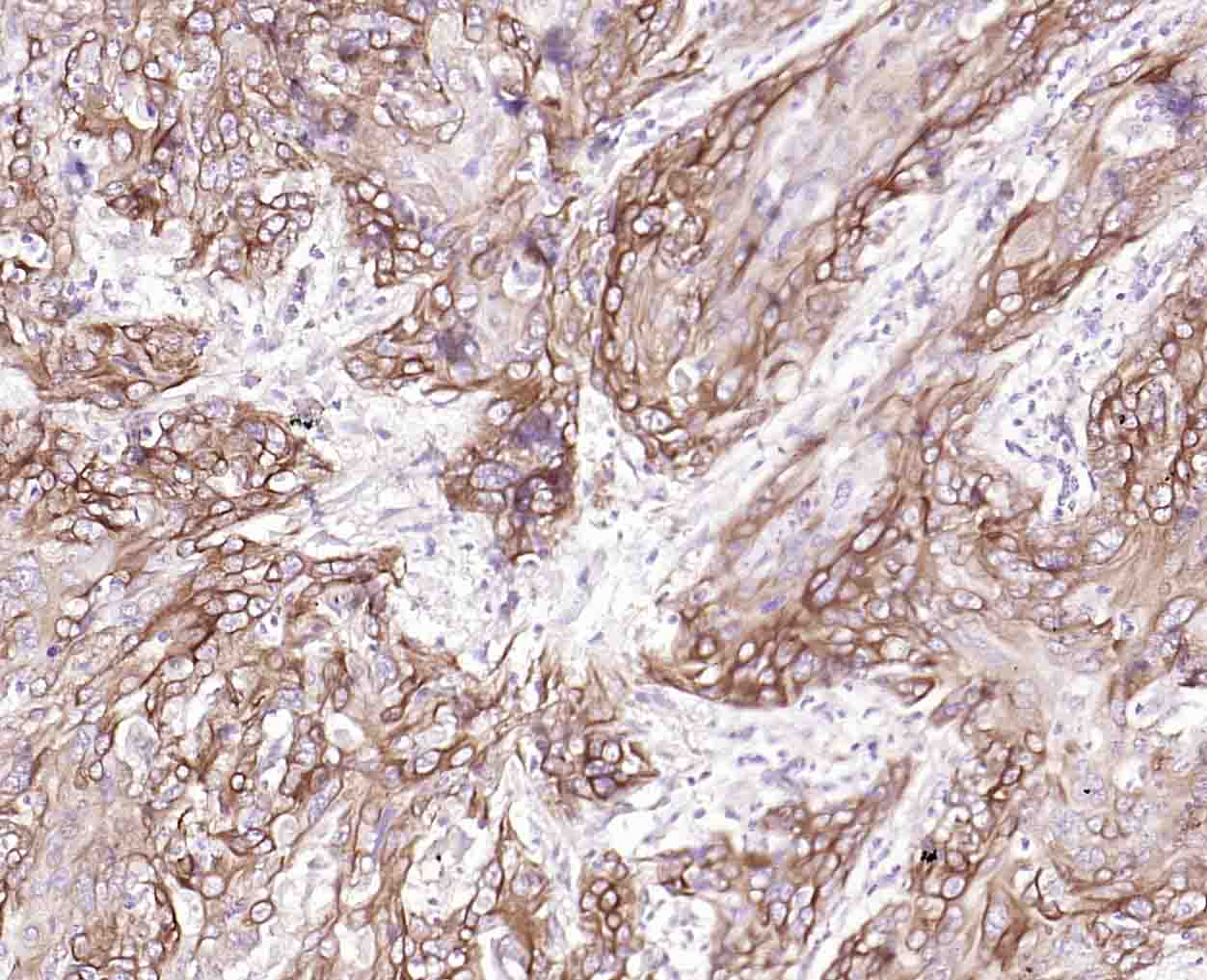 细胞角蛋白14重组兔单克隆抗体