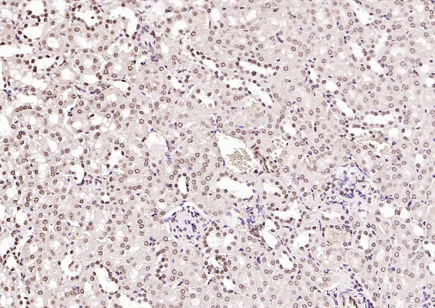 磷酸化血清应答因子抗体-bs-9602R