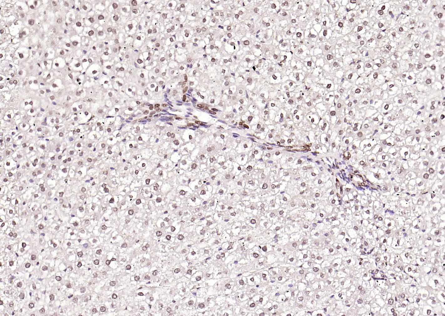 磷酸化血清应答因子抗体-bs-9602R