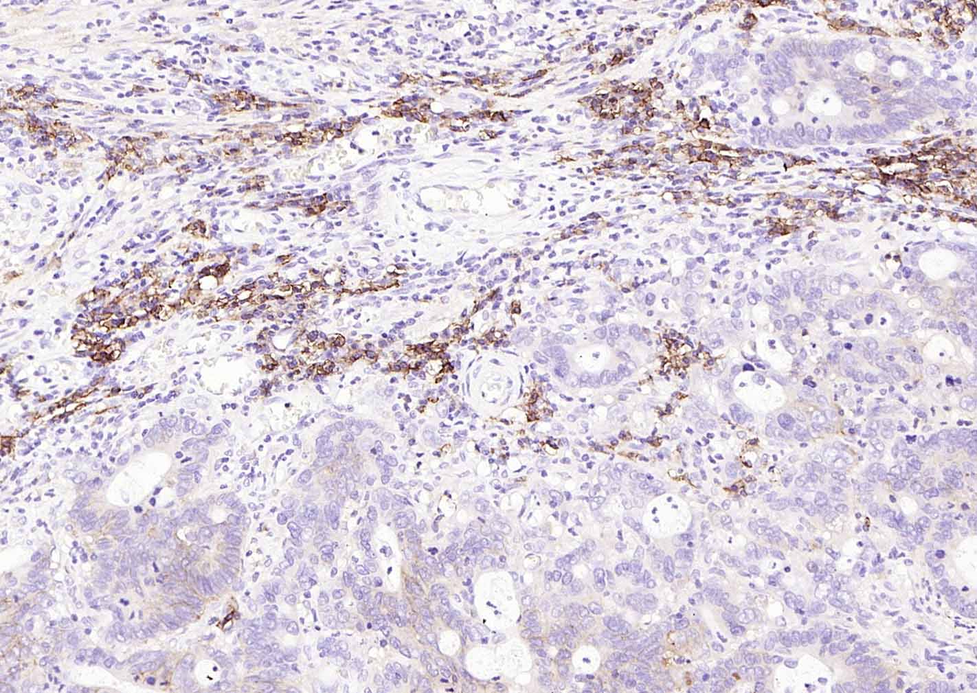 多配体蛋白聚糖1（CD138）重组兔单抗