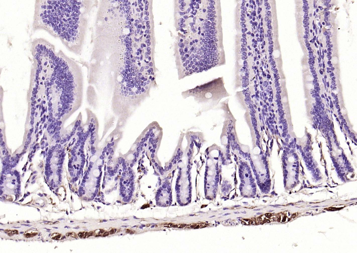神经细胞胞浆蛋白9.5/蛋白基因产物9.5单克隆抗体-bsm-41257M
