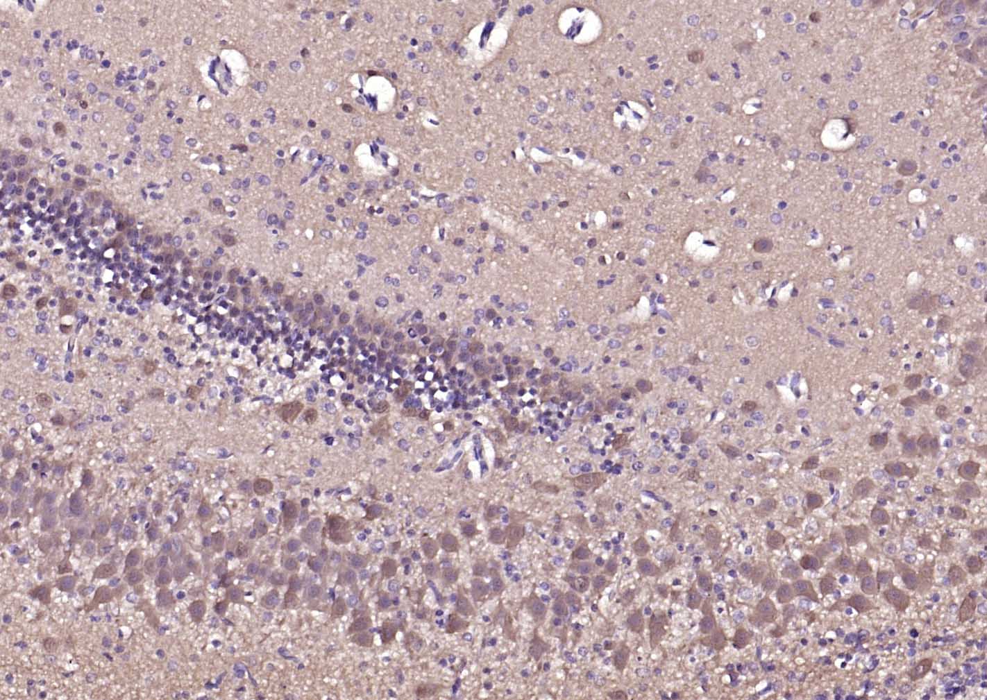 神经细胞胞浆蛋白9.5/蛋白基因产物9.5单克隆抗体-bsm-41257M