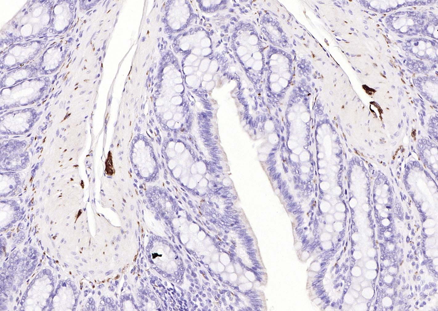 神经细胞胞浆蛋白9.5/蛋白基因产物9.5单克隆抗体-bsm-41257M