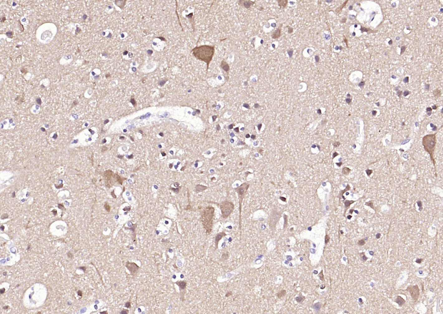 神经细胞胞浆蛋白9.5/蛋白基因产物9.5单克隆抗体-bsm-41257M
