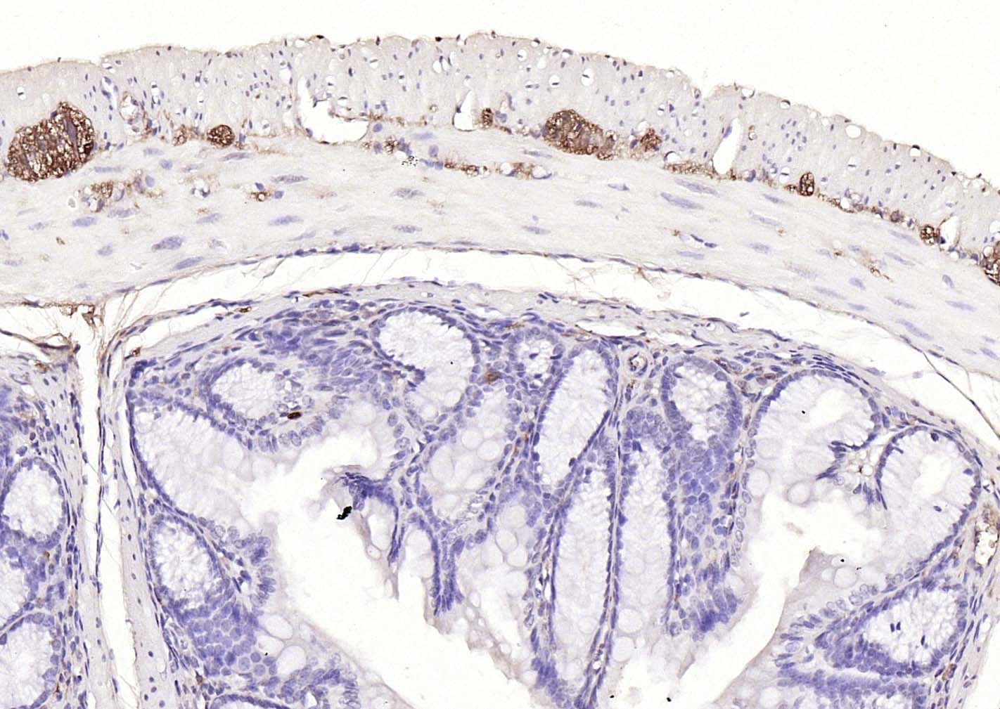 神经细胞胞浆蛋白9.5/蛋白基因产物9.5单克隆抗体-bsm-41257M