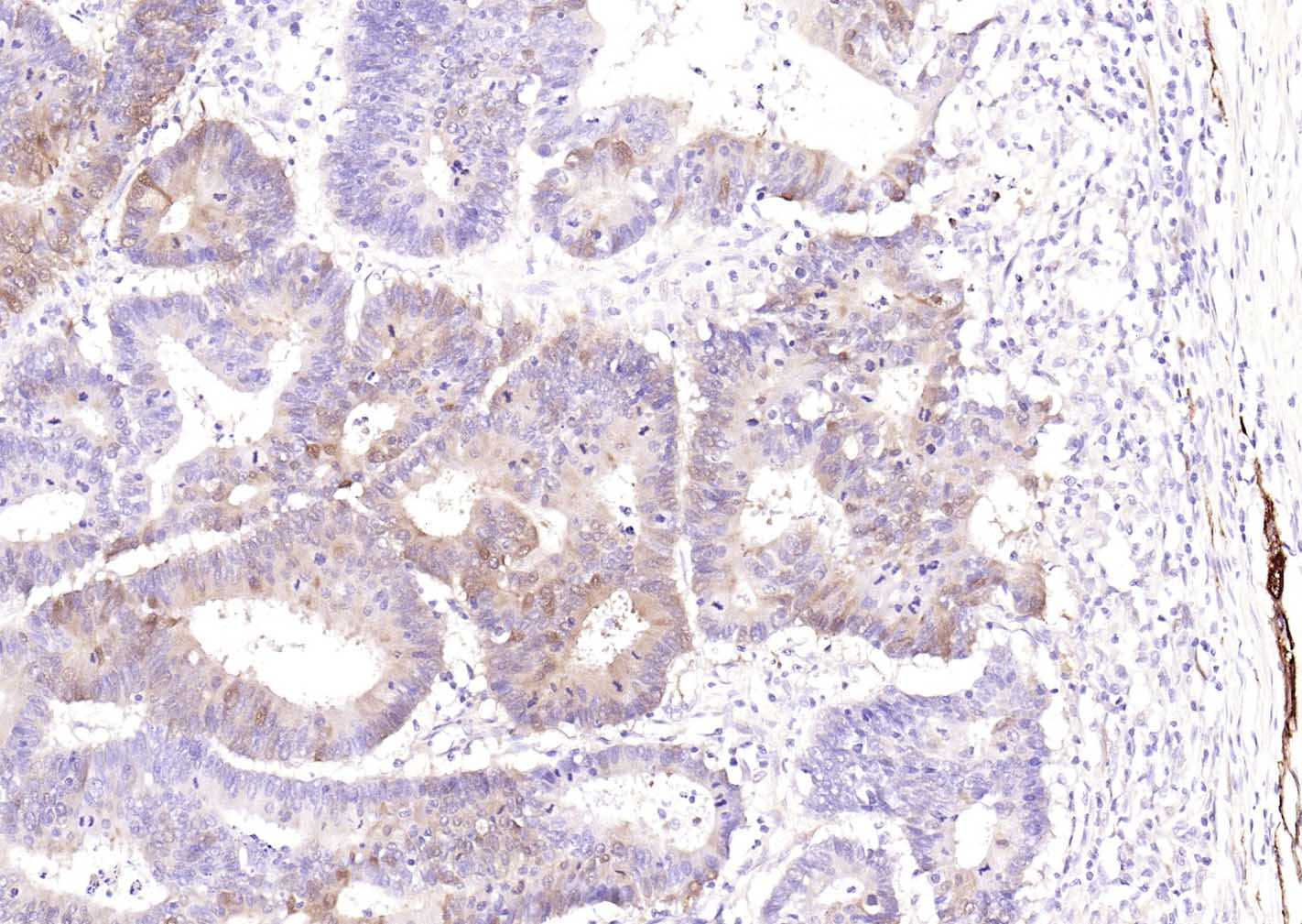 神经细胞胞浆蛋白9.5/蛋白基因产物9.5单克隆抗体-bsm-41257M