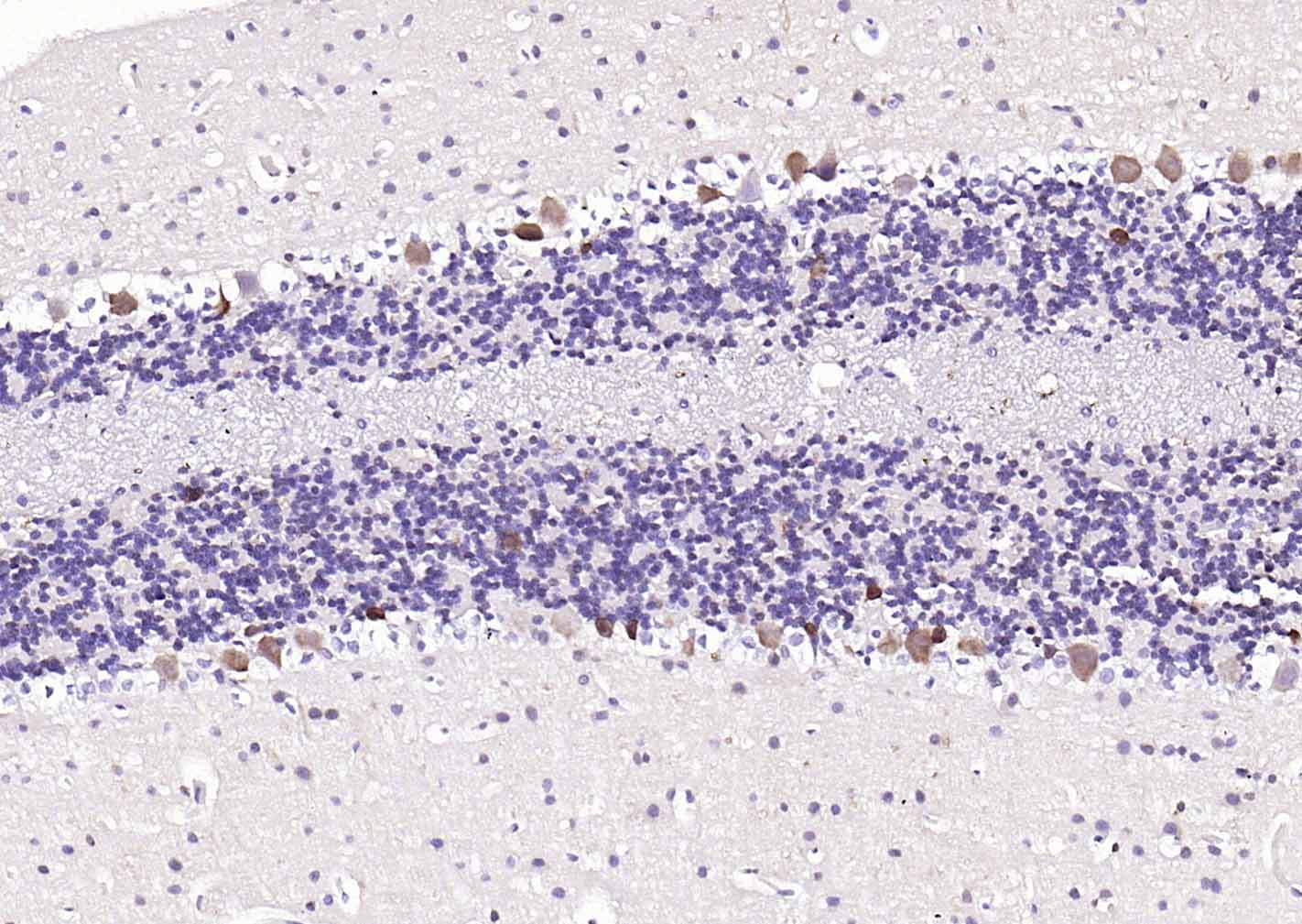 神经细胞胞浆蛋白9.5/蛋白基因产物9.5单克隆抗体-bsm-41257M