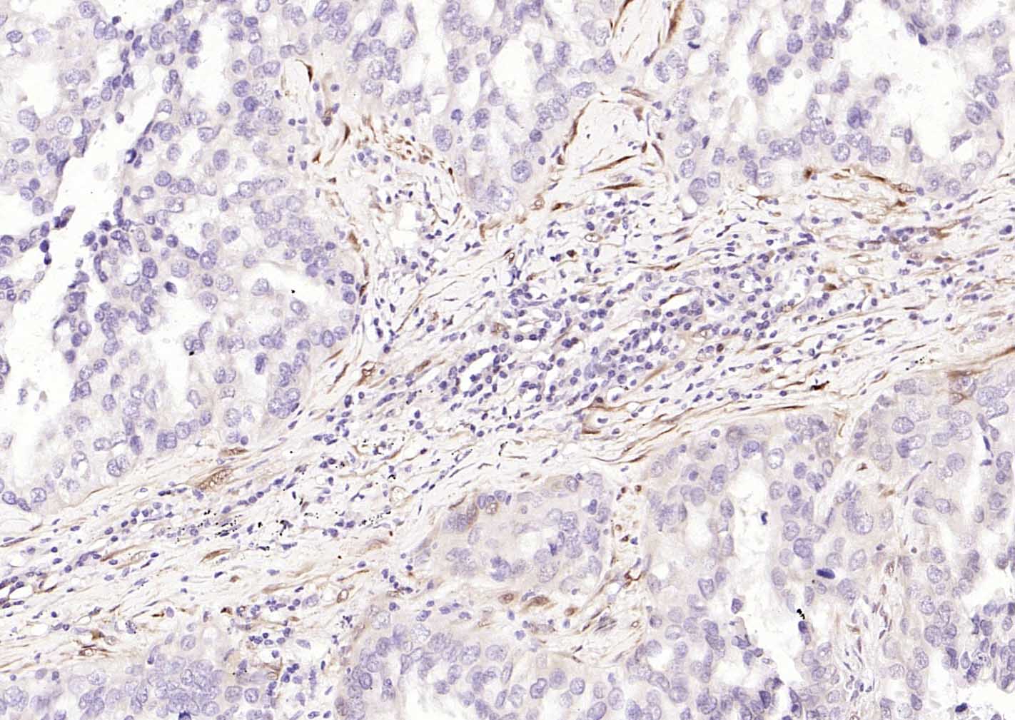 神经细胞胞浆蛋白9.5/蛋白基因产物9.5单克隆抗体-bsm-41257M