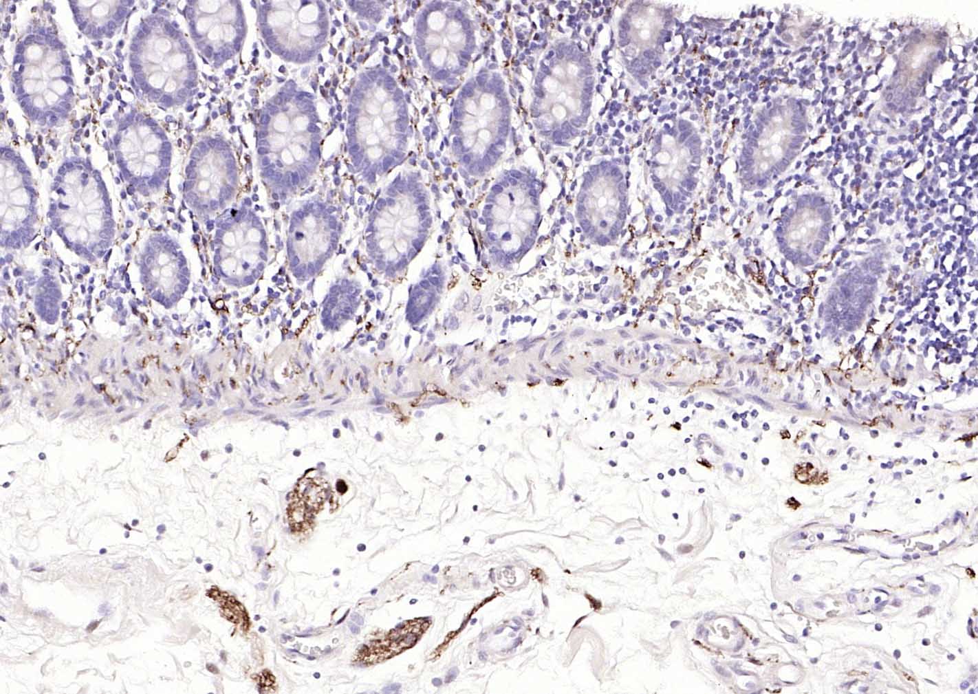 神经细胞胞浆蛋白9.5/蛋白基因产物9.5单克隆抗体-bsm-41257M