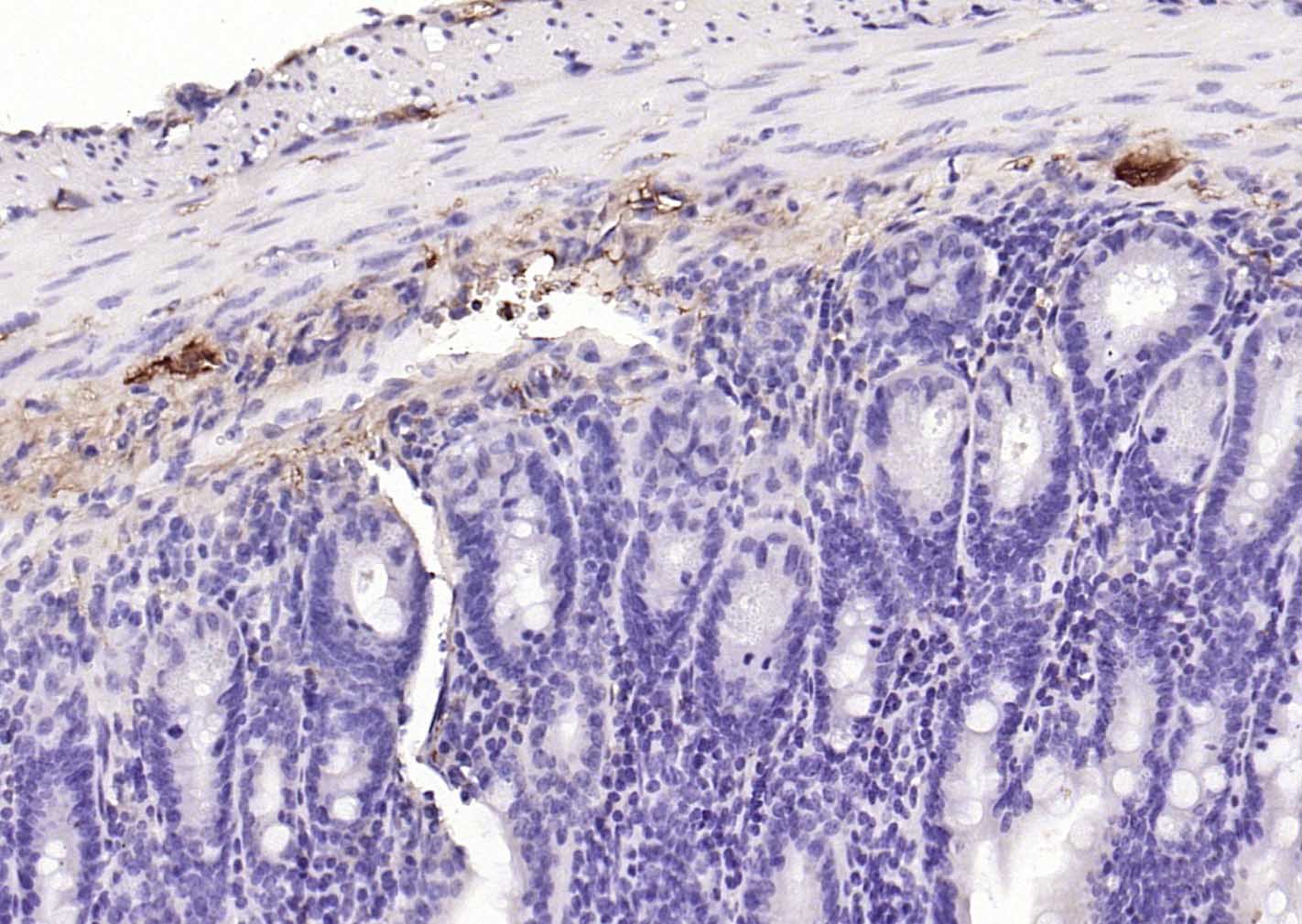神经细胞胞浆蛋白9.5/蛋白基因产物9.5单克隆抗体-bsm-41257M