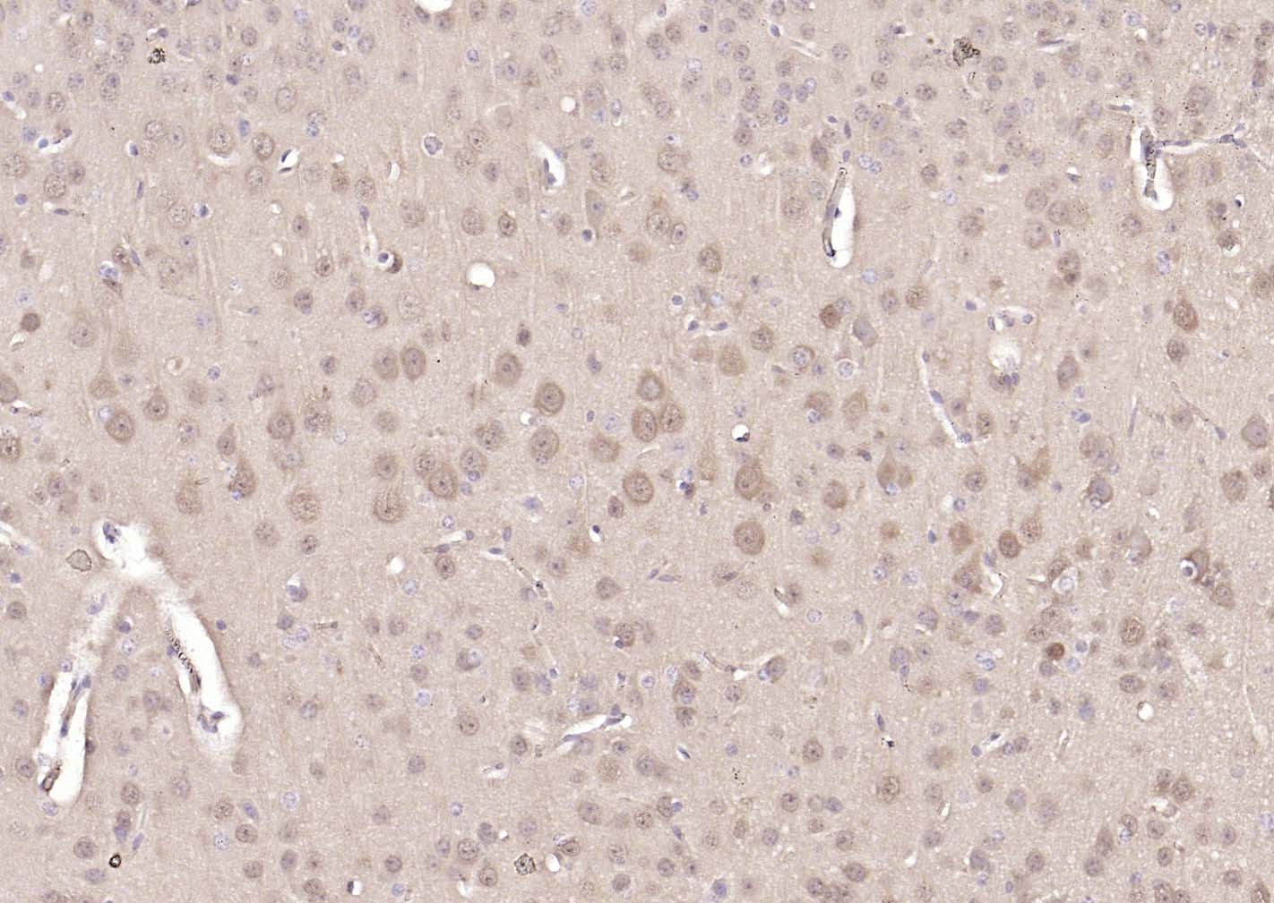 神经细胞胞浆蛋白9.5/蛋白基因产物9.5单克隆抗体-bsm-41257M