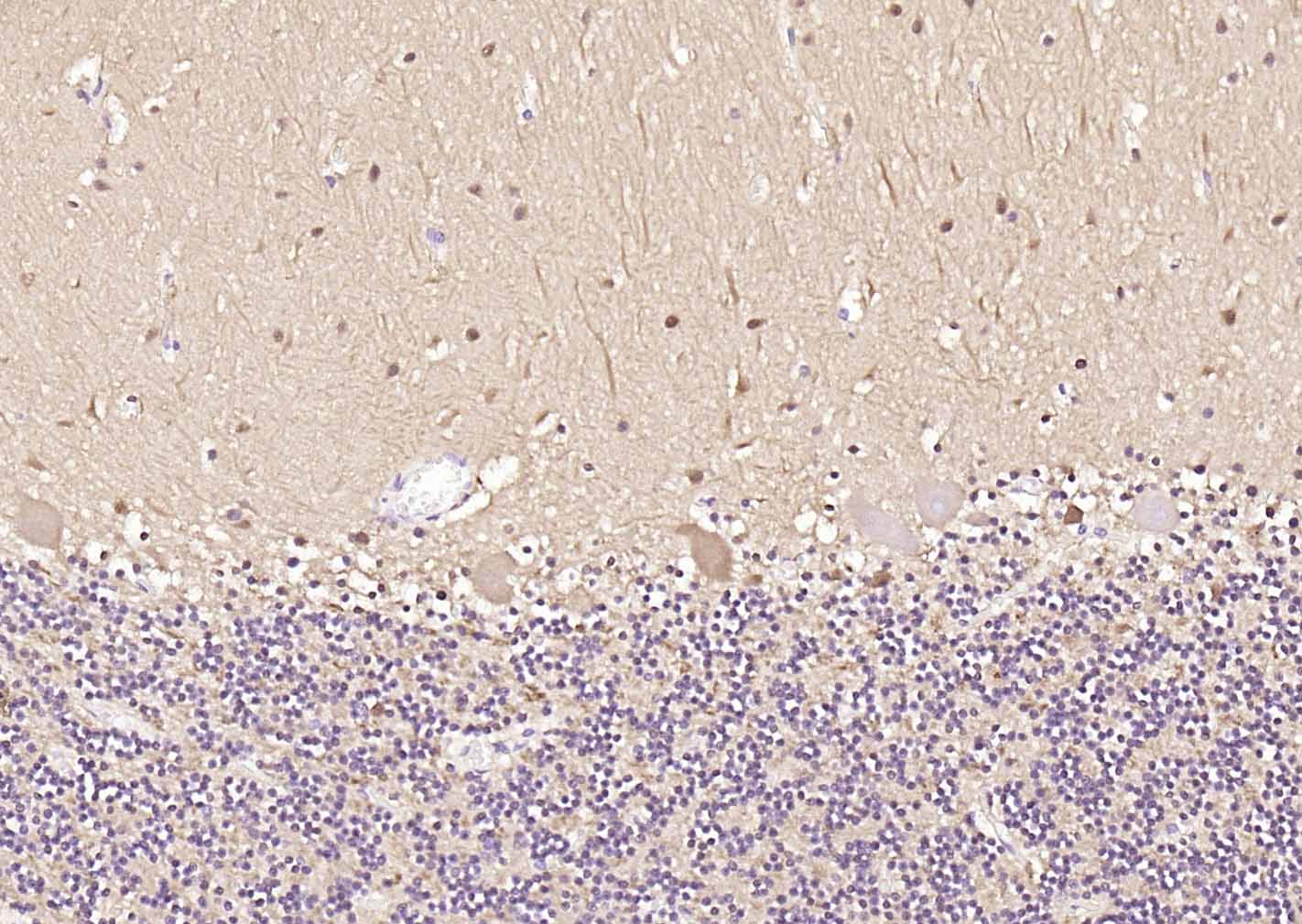 神经细胞胞浆蛋白9.5/蛋白基因产物9.5单克隆抗体-bsm-41257M