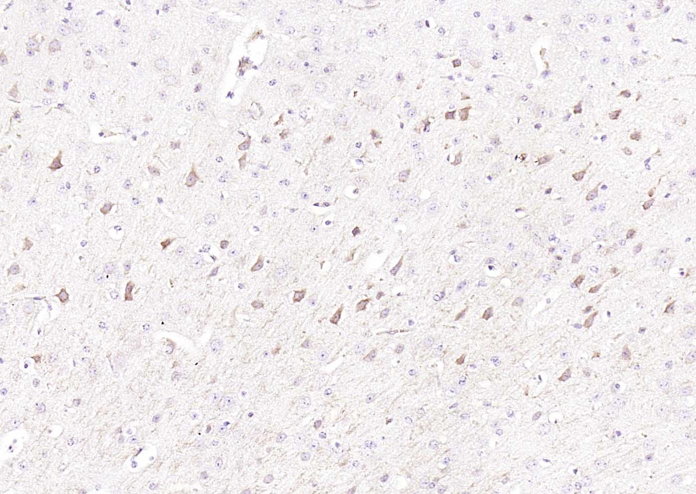 转铁蛋白受体（CD71）抗体-bs-41400R