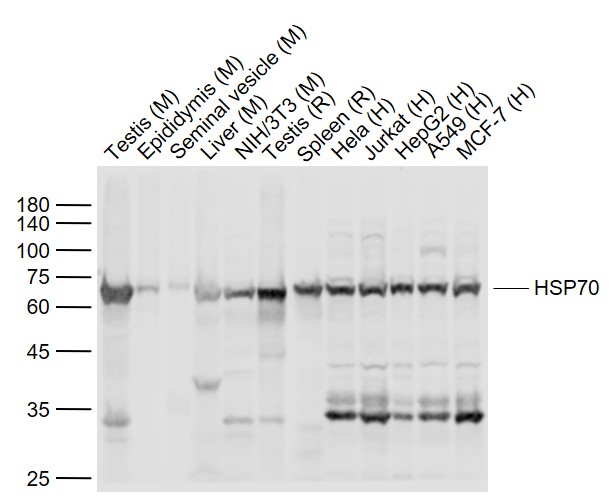 HSP70 Rabbit pAb (一抗) - WB,IHC-P,IHC-F,Flow-Cyt,ICC/IF,IF | Bioss