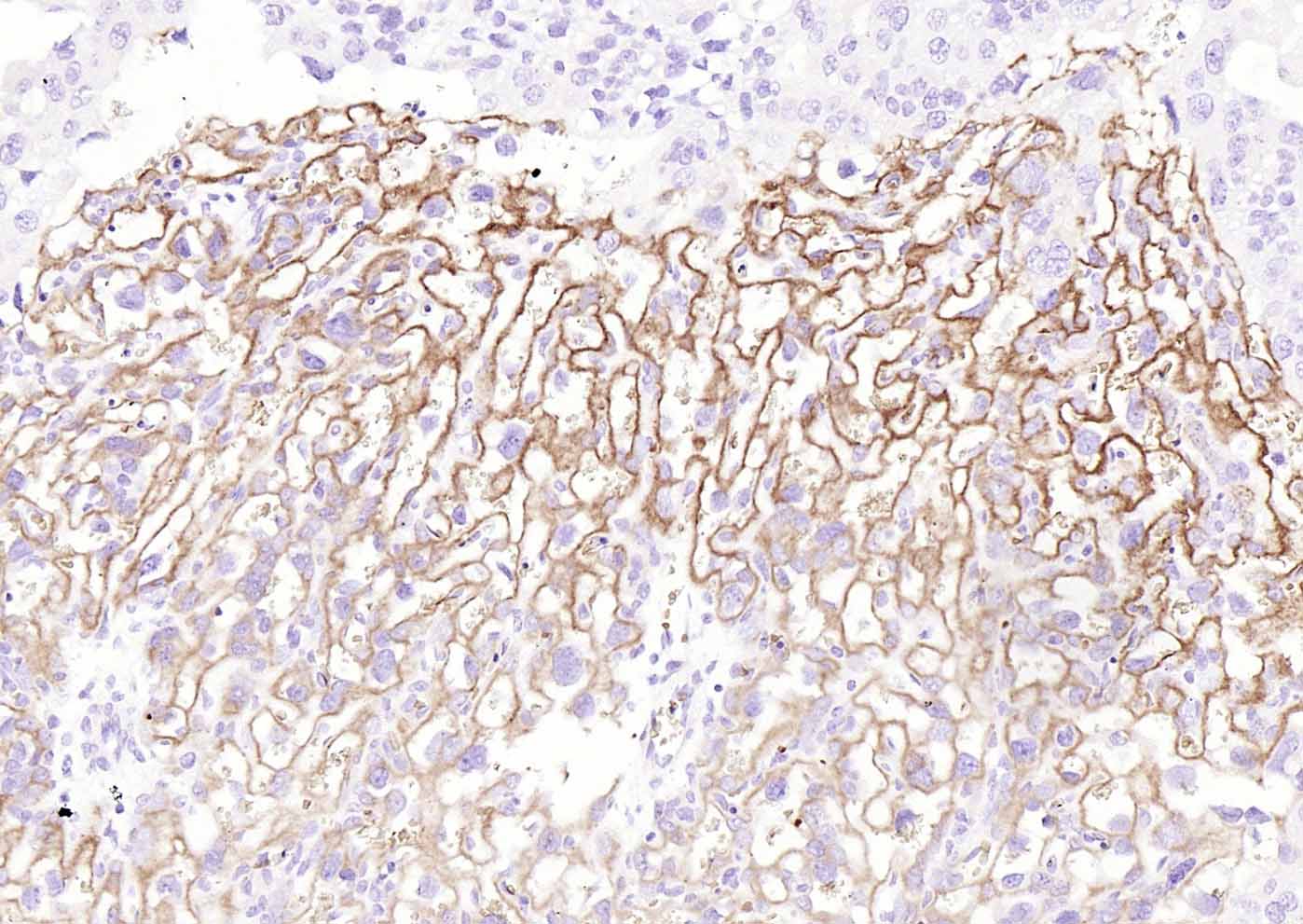 转铁蛋白受体（CD71）抗体-bs-41400R