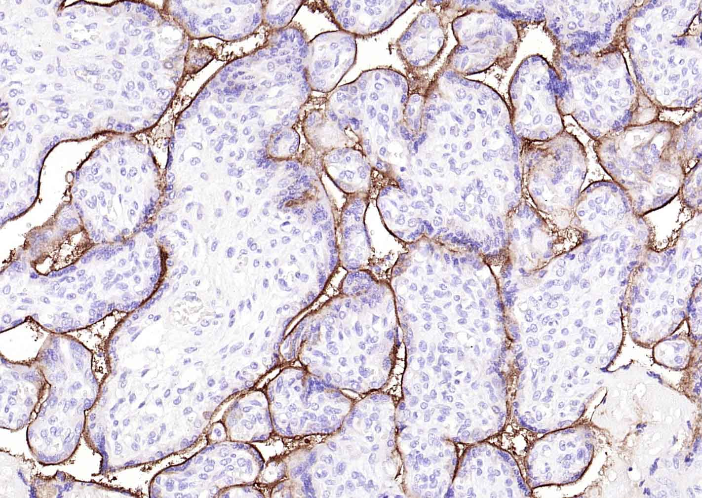 转铁蛋白受体（CD71）抗体-bs-41400R