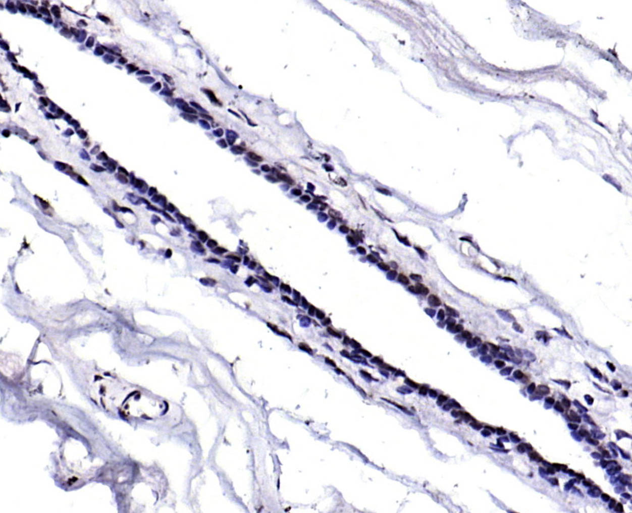 细胞周期基因1蛋白抗体-bs-2812R