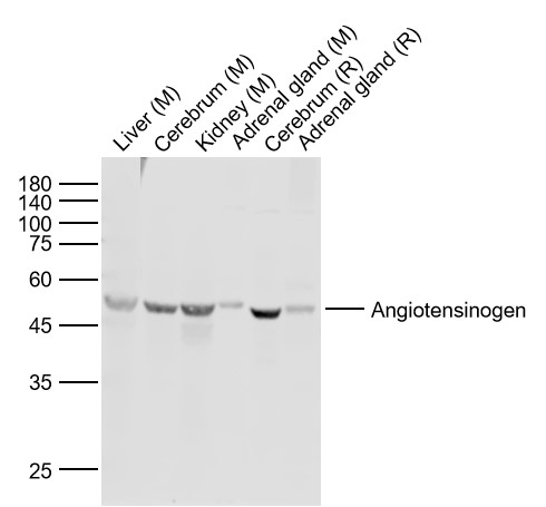 Angiotensin II Rabbit pAb (一抗) | Bioss