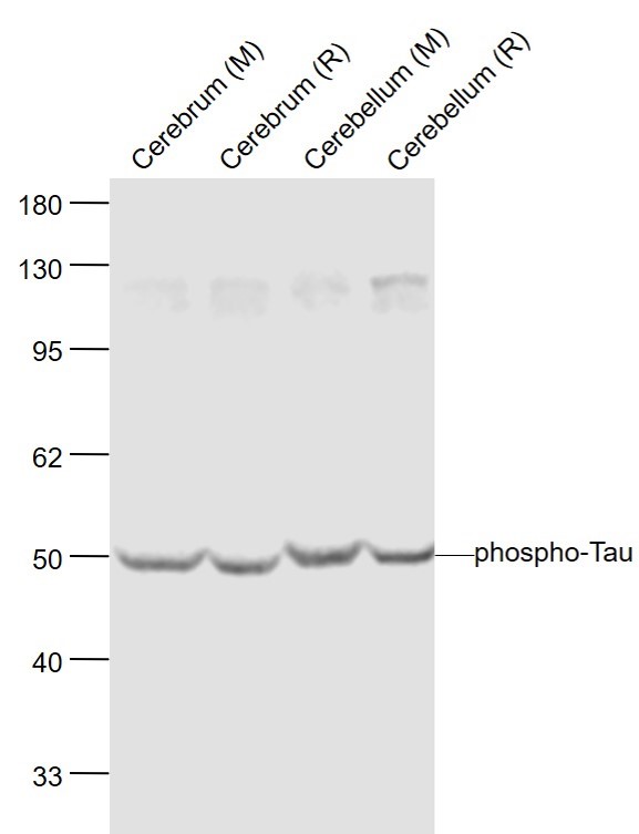 phospho-Tau (Ser262) Rabbit pAb (一抗) - WB,IHC-P,IHC-F,IF,Flow-Cyt | Bioss