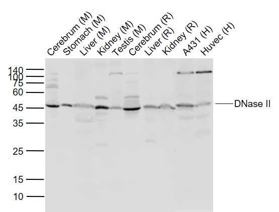 DNase II Rabbit pAb (一抗) - WB | Bioss