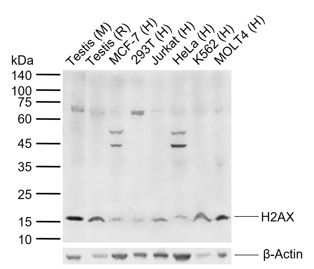 H2AX Rabbit pAb (一抗) - WB,IHC-P,IHC-F,IF | Bioss