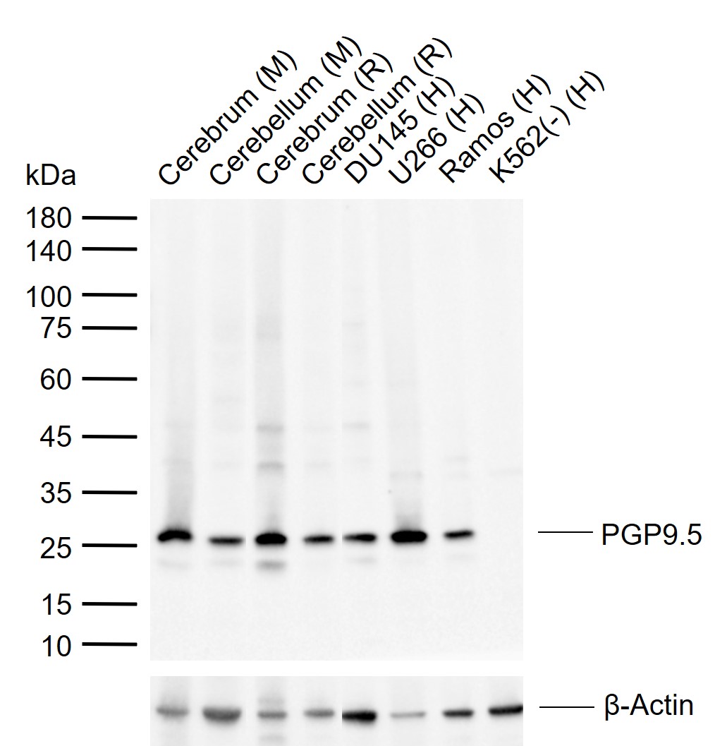 PGP9.5 Mouse mAb (一抗) - WB,IHC-P,IHC-F,IF | Bioss