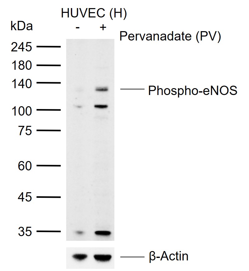 phospho-eNOS (Ser1177) Rabbit pAb (一抗) - WB | Bioss
